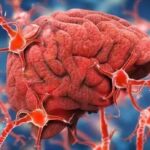 Eli Lilly’s Alzheimer’s Drug Kisunla Secures Marketing Approval in Great Britain