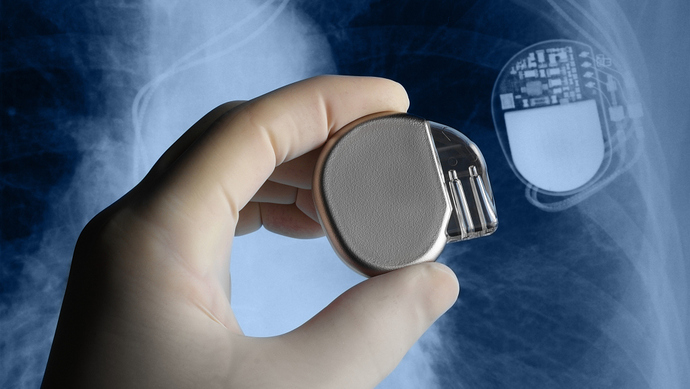 MicroPort Sorim CRM’s PLATINIUM Series ICD Receives NMPA Approval, A First for China