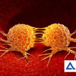 NMPA Approves Alpha Biopharma's Zorifertinib for First-Line NSCLC Treatment with CNS Metastases