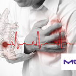 Merck's Winrevair Shows Positive Results in Phase III ZENITH Study for PAH