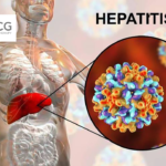 SCG Cell Therapy Presents Phase I Data for HBV-Specific TCR-T Therapy SCG101 at AASLD 2024