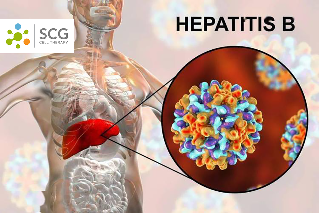 SCG Cell Therapy Presents Phase I Data for HBV-Specific TCR-T Therapy SCG101 at AASLD 2024