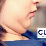 Cutia Therapeutic's CU-20401 Shows Positive Results in Phase II Subcutaneous Fat Reduction Study