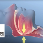 Huadong Medicine Receives FDA Clearance for HDM1005 Clinical Study in Obstructive Sleep Apnea