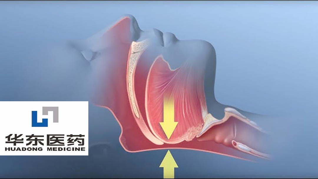 Huadong Medicine Receives FDA Clearance for HDM1005 Clinical Study in Obstructive Sleep Apnea