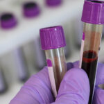 CStone Pharmaceuticals Presents CS5001 Clinical Data at the ASH Annual Meeting