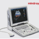 NMPA Approves Shenzhen Mindray's Innovative Dual-Mode Ultrasound Diagnostic System
