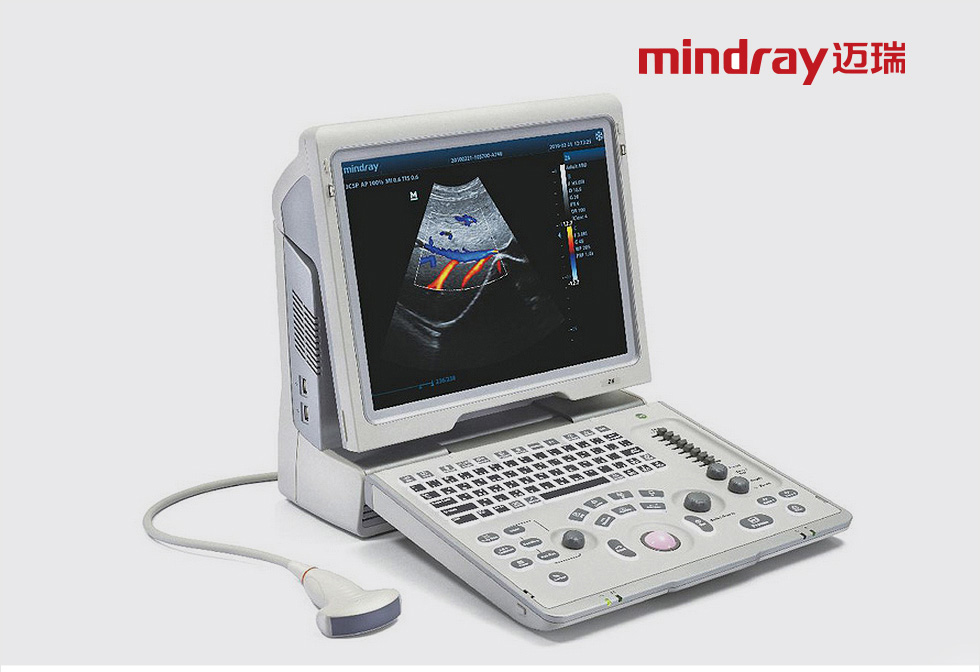 NMPA Approves Shenzhen Mindray’s Innovative Dual-Mode Ultrasound Diagnostic System