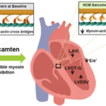 Bayer AG Secures Exclusive Rights to Cytokinetics' Aficamten in Japan