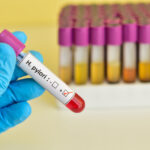 Hasten Biopharmaceutical Initiates Phase III Clinical Trial for Lerodalcibep in China