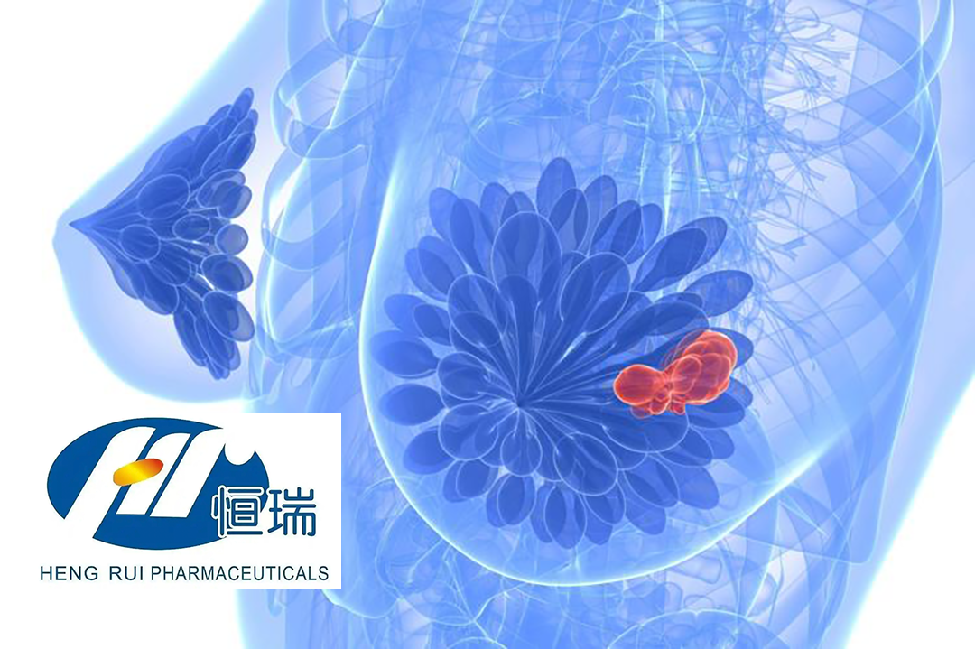 Jiangsu Hengrui Pharmaceuticals' Fluzoparib and Apatinib Gain NMPA Approval for Metastatic Breast Cancer Treatment