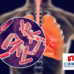 Shenyang Hongqi Pharma Secures NMPA Approval for Pretomanid in TB Treatment