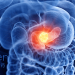 Innovent Biologics' IBI343 Shows Promising Results in Phase I Study for Pancreatic Cancer at ESMO Asia