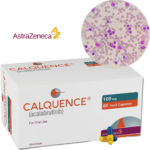 AstraZeneca's Calquence Combo Shows 35% Reduced Risk in CLL: AMPLIFY Phase III Results