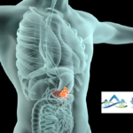 Immunofoco's IMC002 Earns FDA Fast-Track Designation for CLDN 18.2-Positive Gastric Cancer