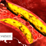 Keymed Biosciences Presents CM336 Data for Relapsed Multiple Myeloma at ASH Annual Meeting