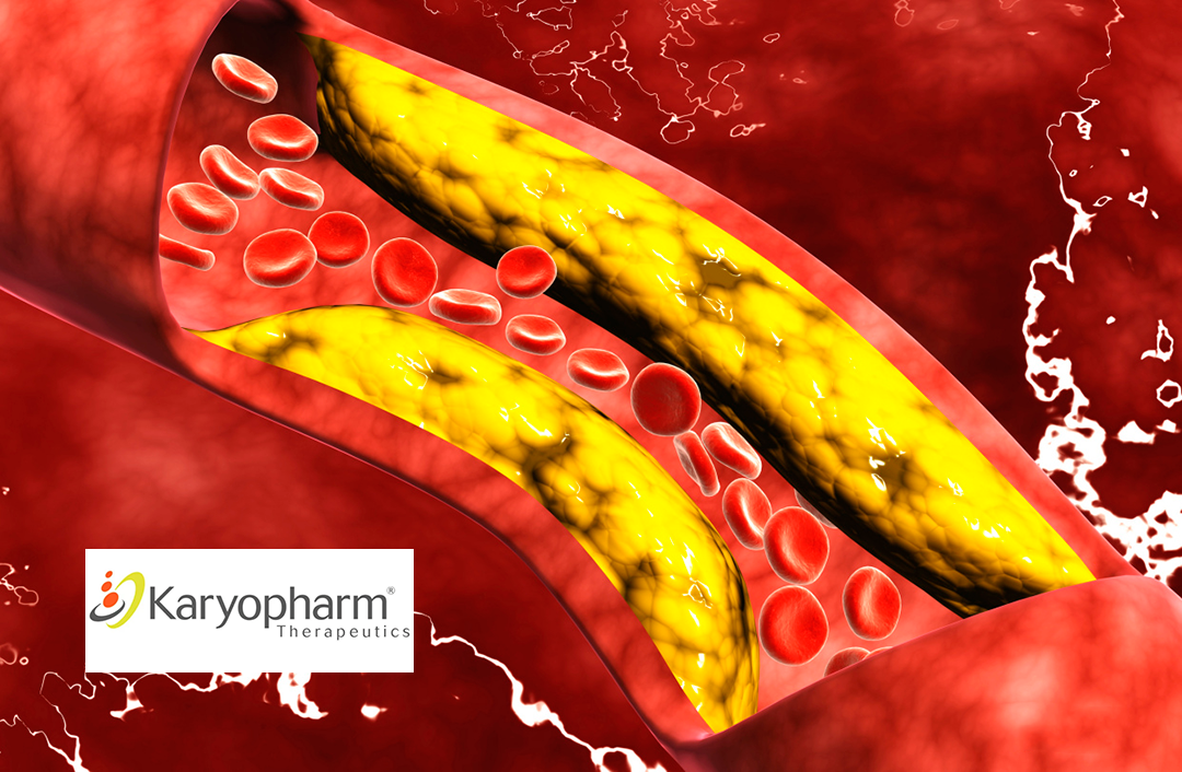 Keymed Biosciences Presents CM336 Data for Relapsed Multiple Myeloma at ASH Annual Meeting