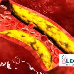 Legend Biotech's Carvykti Demonstrates High MRD Negativity Rates in Phase III CARTITUDE-4 Trial