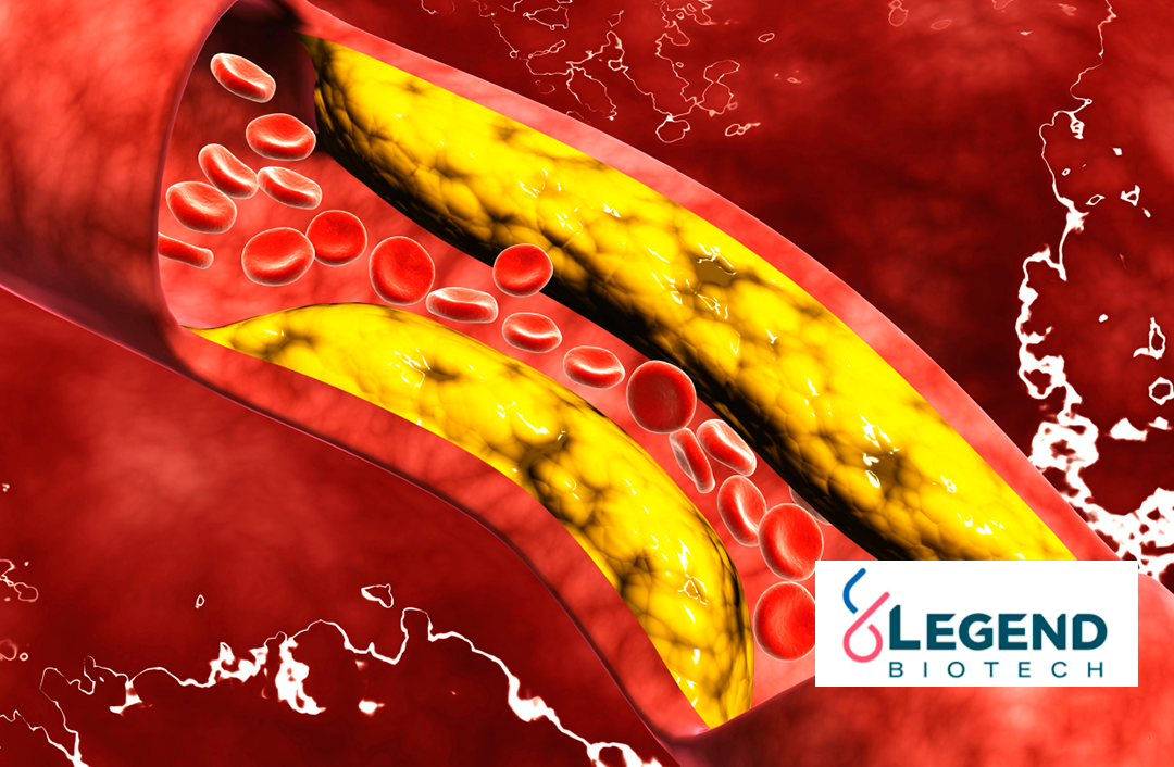 Legend Biotech’s Carvykti Demonstrates High MRD Negativity Rates in Phase III CARTITUDE-4 Trial