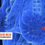 Transcenta's LIV-1 ADCs Show Promising Results in Pre-Clinical Breast Cancer Study