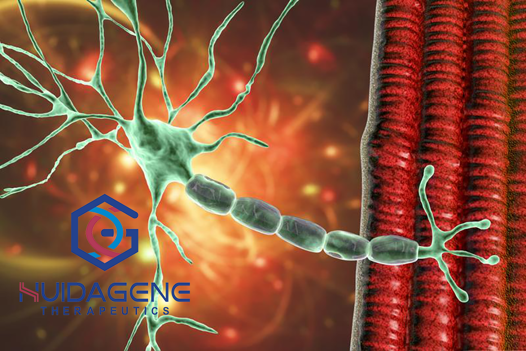 HuidaGene Therapeutics Launches MUSCLE Study for CRISPR Therapy in Duchenne Muscular Dystrophy