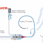 Johnson & Johnson MedTech's Impella Heart Pumps Gain FDA Approval for Pediatric Heart Failure