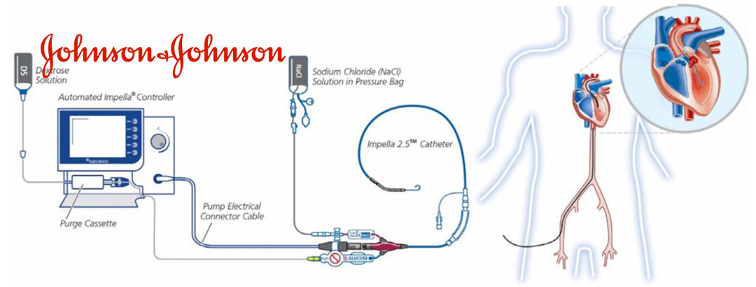 Johnson & Johnson MedTech's Impella Heart Pumps Gain FDA Approval for Pediatric Heart Failure