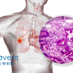 "Innovent Biologics Initiates Phase I Trial for IBI3009 in Small Cell Lung Cancer and Neuroendocrine Tumors
