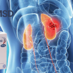 European CHMP Supports Conditional Approval of MSD's Welireg for VHL Disease and RCC
