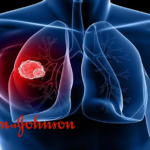 J&J's SC Amivantamab Faces Complete Response Letter from FDA for NSCLC Treatment