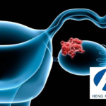 Jiangsu Hengrui's Trastuzumab Rezetecan on Track for NMPA's Breakthrough Therapy Designation