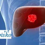 Abbisko Therapeutics Receives NMPA Approval for Irpagratinib Regulatory Study