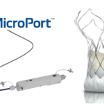 MicroPort CardioFlow's VitaFlow Liberty Receives Marketing Approval in Turkey