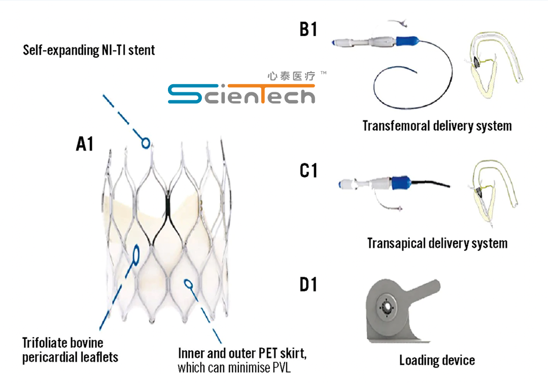 Lepu Scientech’s ScienCcrown TAVR System Earns NMPA Medical Device License