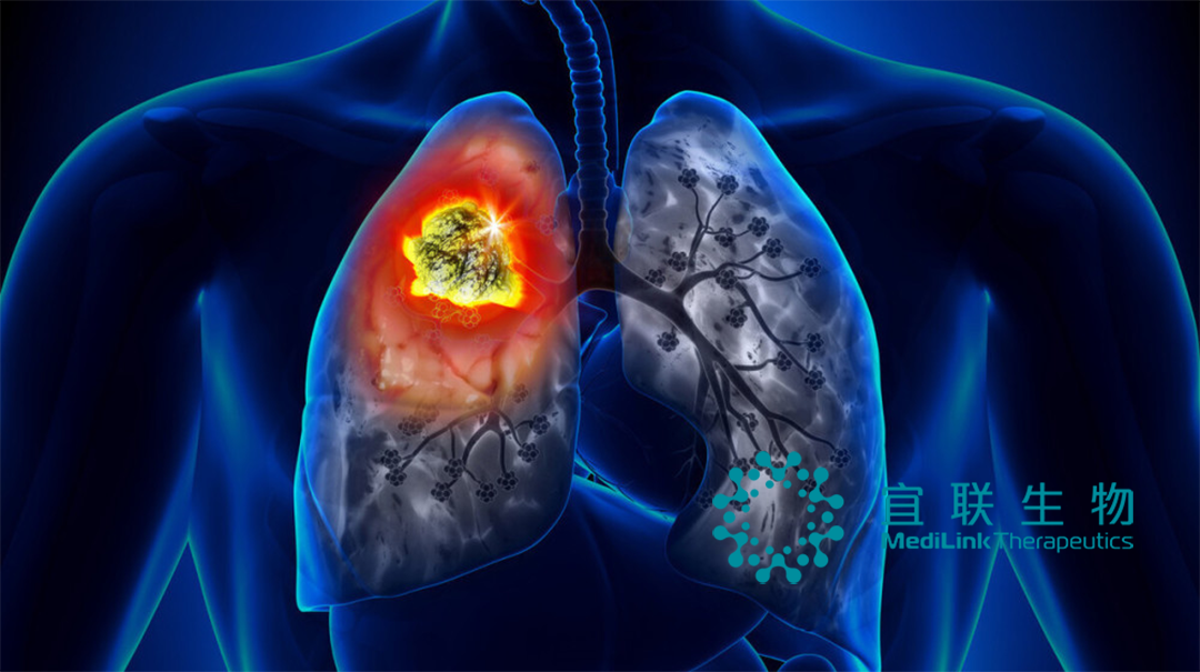 MediLink Therapeutics’ YL201 Receives FDA Orphan Drug Designation for Small-Cell Lung Cancer