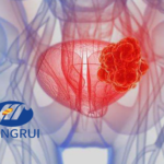 Jiangsu Hengrui Pharmaceuticals Gets NMPA Approval for SHR-1501 Combo in Bladder Cancer