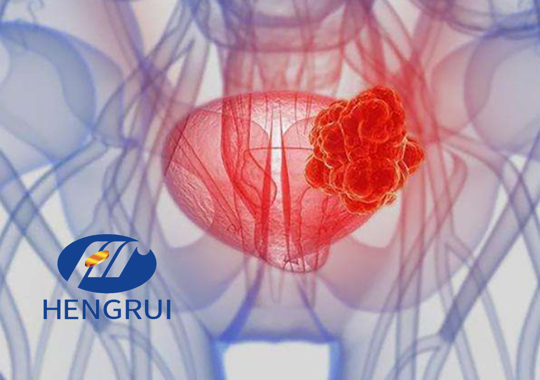 Jiangsu Hengrui Pharmaceuticals Gets NMPA Approval for SHR-1501 Combo in Bladder Cancer