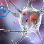 Roche's Prasinezumab Shows Promise in Phase IIb PADOVA Study for Early-Stage Parkinson's Disease