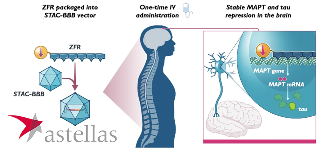 Astellas Pharma Inks Licensing Deal with Sangamo Therapeutics for Neurological AV Capsid STAC-BBB