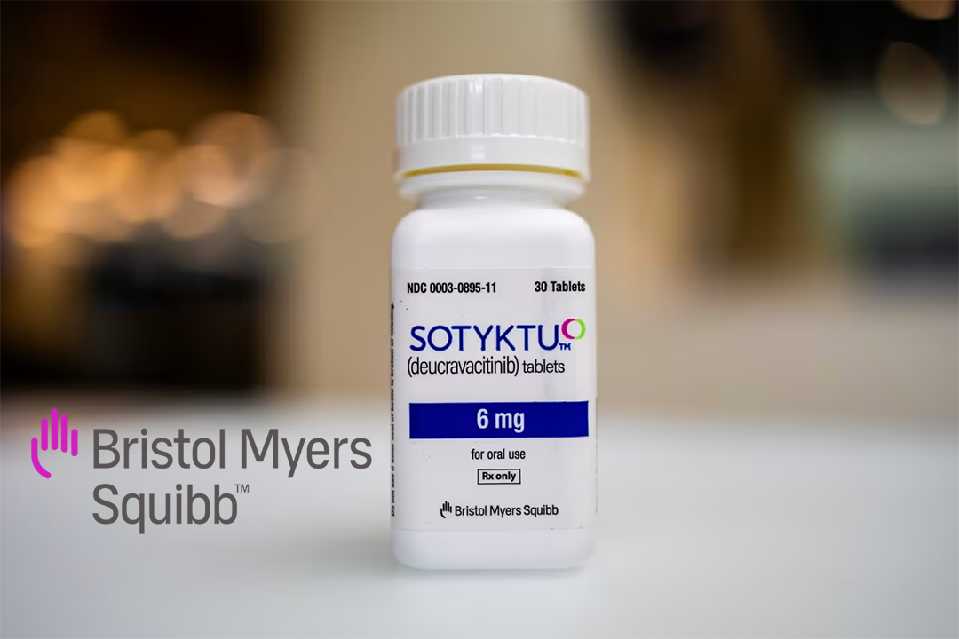 Bristol-Myers Squibb’s Sotyktu Meets Primary Endpoints in POETYK PsA Studies