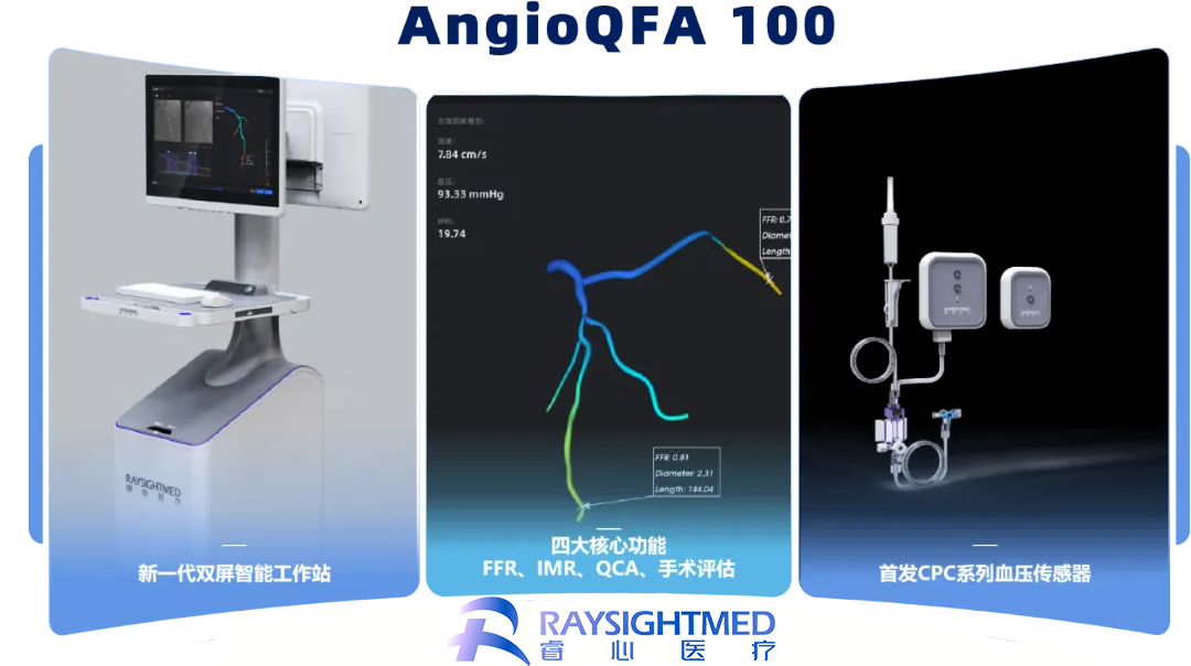 RaysightMed’s AngioQFA 100 Receives NMPA Approval for Coronary Artery Function Measurement