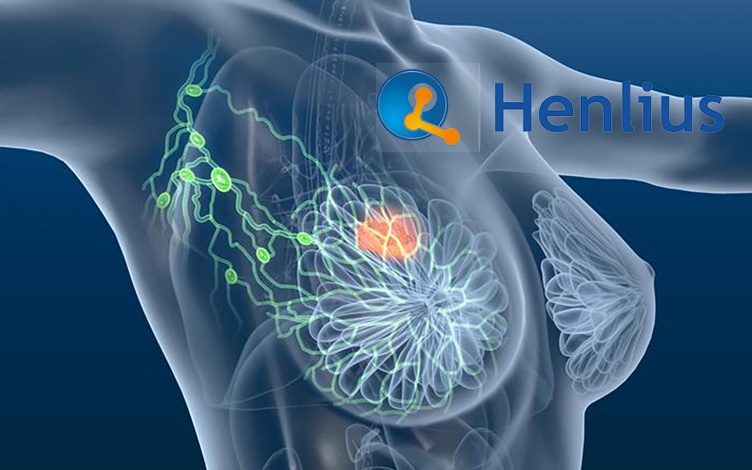 Shanghai Henlius Biotech Initiates Patient Dosing in Global Phase III ELAINE-3 Study for Lasofoxifene