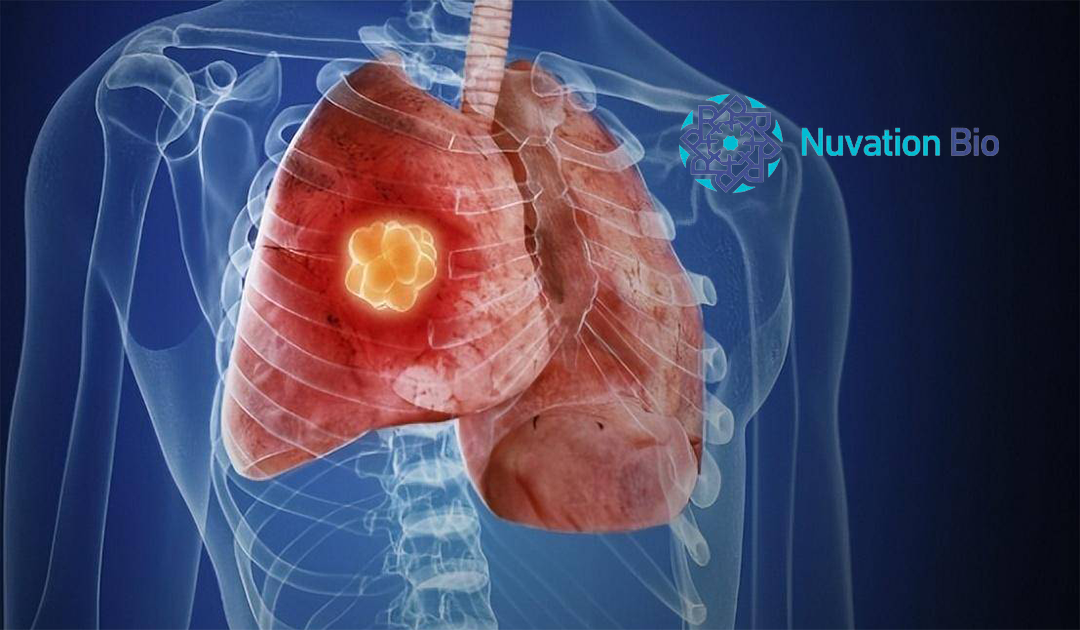 Nuvation Bio’s Taletrectinib NDA for ROS1+ NSCLC Receives FDA Priority Review