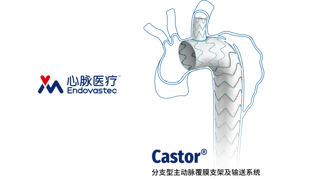 MicroPort Endovascular MedTech’s Castor® Branched Stent Wins China Patent Gold Award