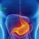 CARsgen Therapeutics' Satricabtagene Autoleucel Shows Positive Results in Phase II Study