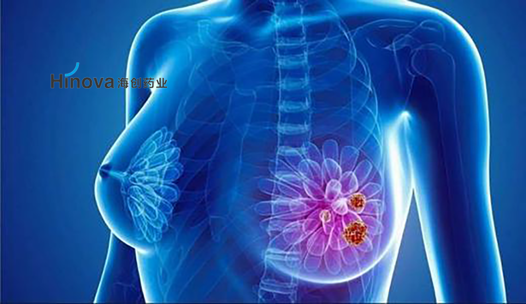 Hinova Pharmaceuticals' HP568 Earns FDA Clinical Trial Approval for ER+/HER2- Breast Cancer