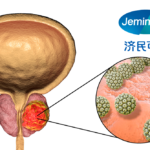 Jiangxi Jemincare Group Gets NMPA Approval for Prostate Cancer Drug JMX-2006