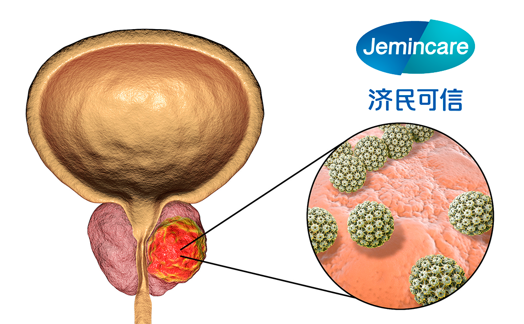 Jiangxi Jemincare Group Gets NMPA Approval for Prostate Cancer Drug JMX-2006