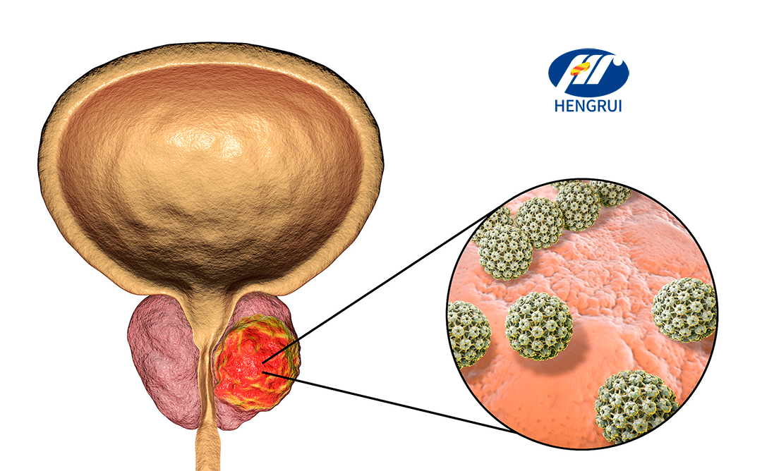 Jiangsu Hengrui Pharmaceuticals Secures NMPA Approvals for Prostate Cancer and Solid Tumor Clinical Trials