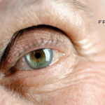 Frontera Therapeutics Advances to Phase II with FT-003 for Diabetic Macular Edema